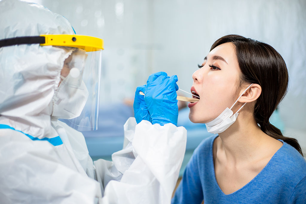 Kemenkes: Tarif Test Cepat PCR Tak Boleh Lampaui Tarif Tertinggi