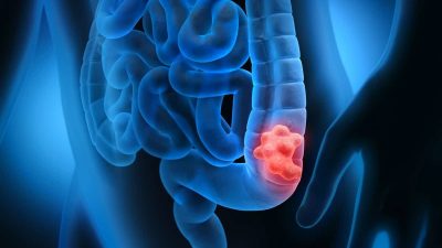 भिडियो स्टोरी: मानसिक रोग उपचारमा प्रयोग गरिने इसिटी के हो&hellip;