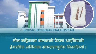 नर्भिकमा निकालियो तीन महिनाका बालकको पेटमा अड्किएको हेयरपिन