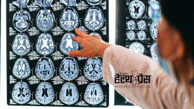 कोभिड र लकडाउनका कारण दिमागमा नकारात्मक असर, स्वस्थ मानिसको मस्तिष्क…