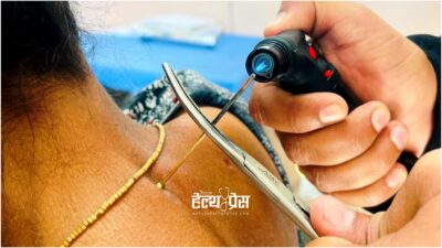 मांसपेसीको दुखाइमा ‘अग्निकर्म’को प्रभावबारे सुर्खेतमा अनुसन्धान गरिने