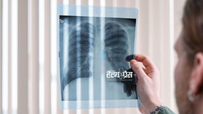रगत परीक्षणबाट ५ वर्ष अघि नै फोक्सोको क्यान्सरको जोखिम थाहा&hellip;