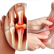 यूरिक एसिड बढ्दा के खाने के नखाने